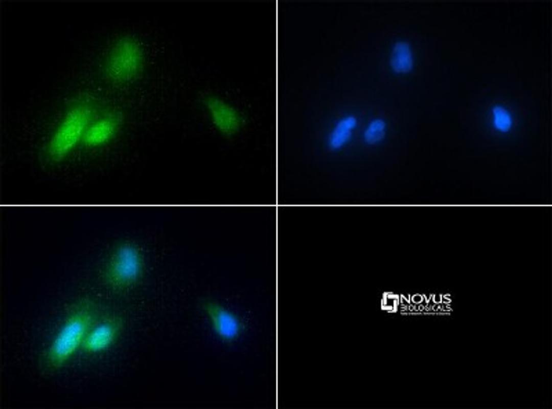 Immunocytochemistry/Immunofluorescence: CHORDC1 Antibody [NBP1-78304] - Antibody was tested in HeLa cells with FITC (green). Nuclei were counterstained with DAPI (blue).