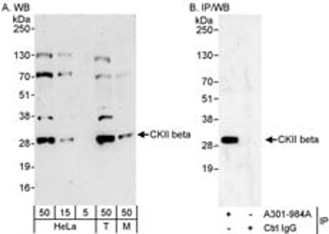 Detection of human and mouse CKII beta by western blot (h&m) and immunoprecipitation (h).