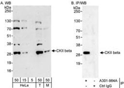 Detection of human and mouse CKII beta by western blot (h&m) and immunoprecipitation (h).