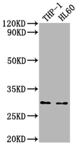 Western Blot. Positive WB detected in: THP-1 whole cell lysate, HL60 whole cell lysate. All lanes: OSCAR antibody at 1:2000. Secondary. Goat polyclonal to rabbit IgG at 1/50000 dilution. Predicted band size: 31, 29, 30, 28 kDa. Observed band size: 31 kDa. 
