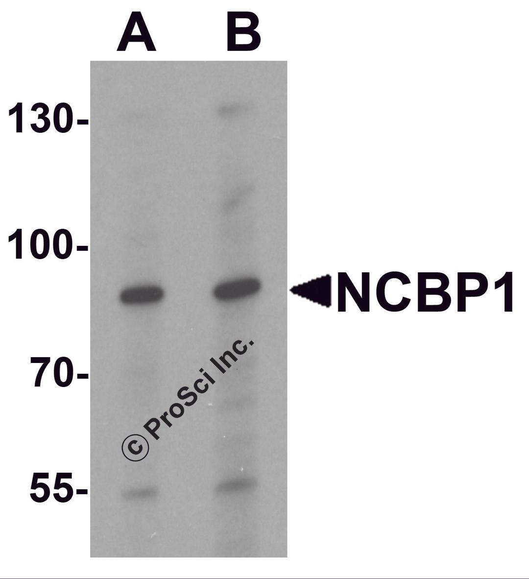Western blot analysis of NCBP1 in HeLa cell lysate with NCBP1 antibody at (A) 1 and (B) 2 μg/mL.