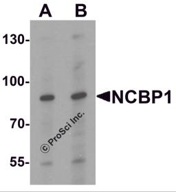 Western blot analysis of NCBP1 in HeLa cell lysate with NCBP1 antibody at (A) 1 and (B) 2 μg/mL.