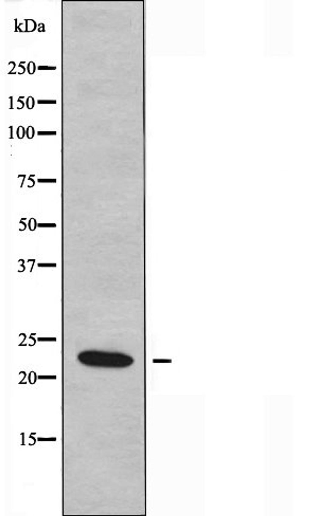 Western blot analysis of HepG2 cells using NMU antibody