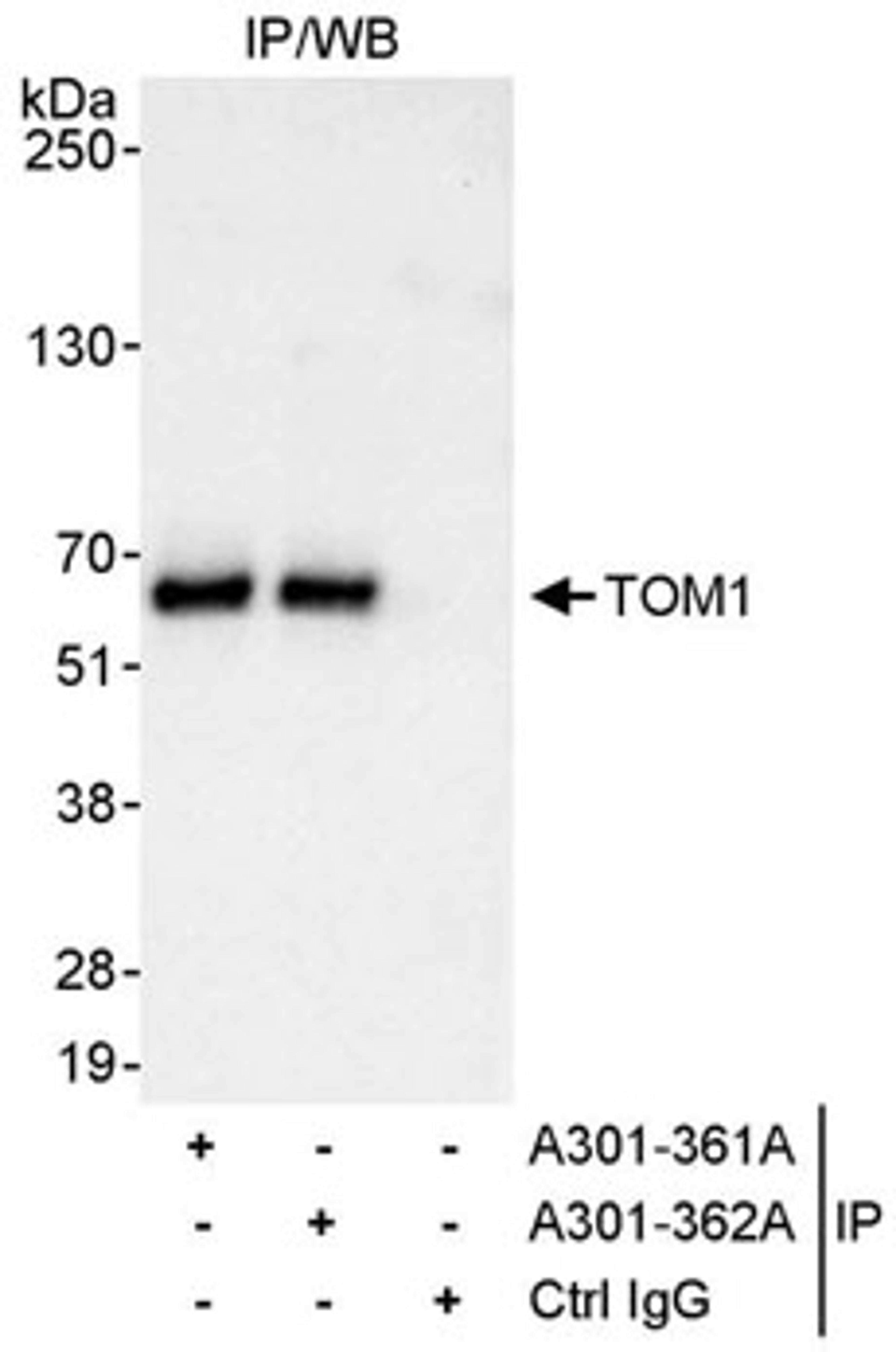 Detection of human TOM1 by western blot of immunoprecipitates.