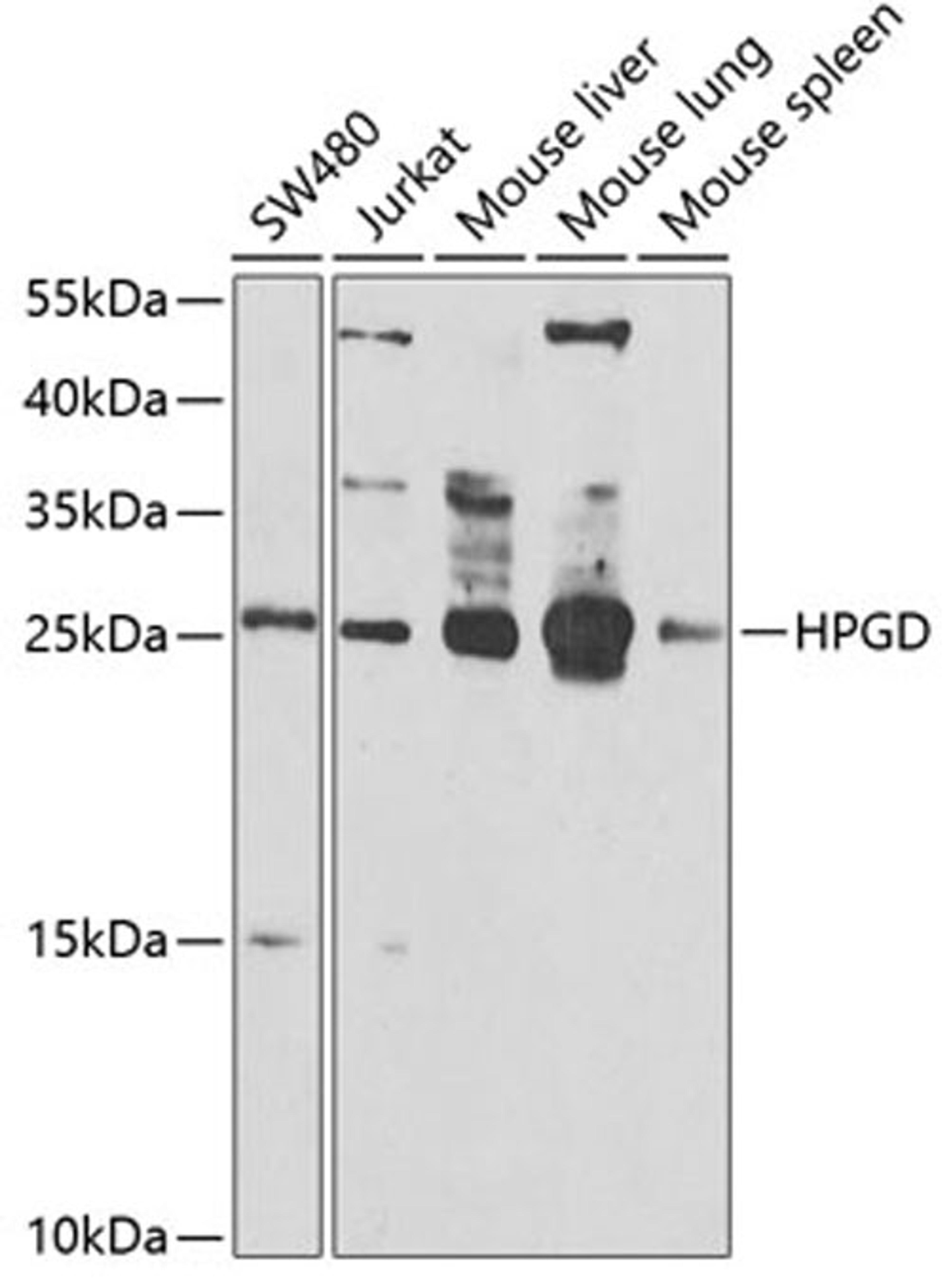 Western blot - HPGD antibody (A6926)