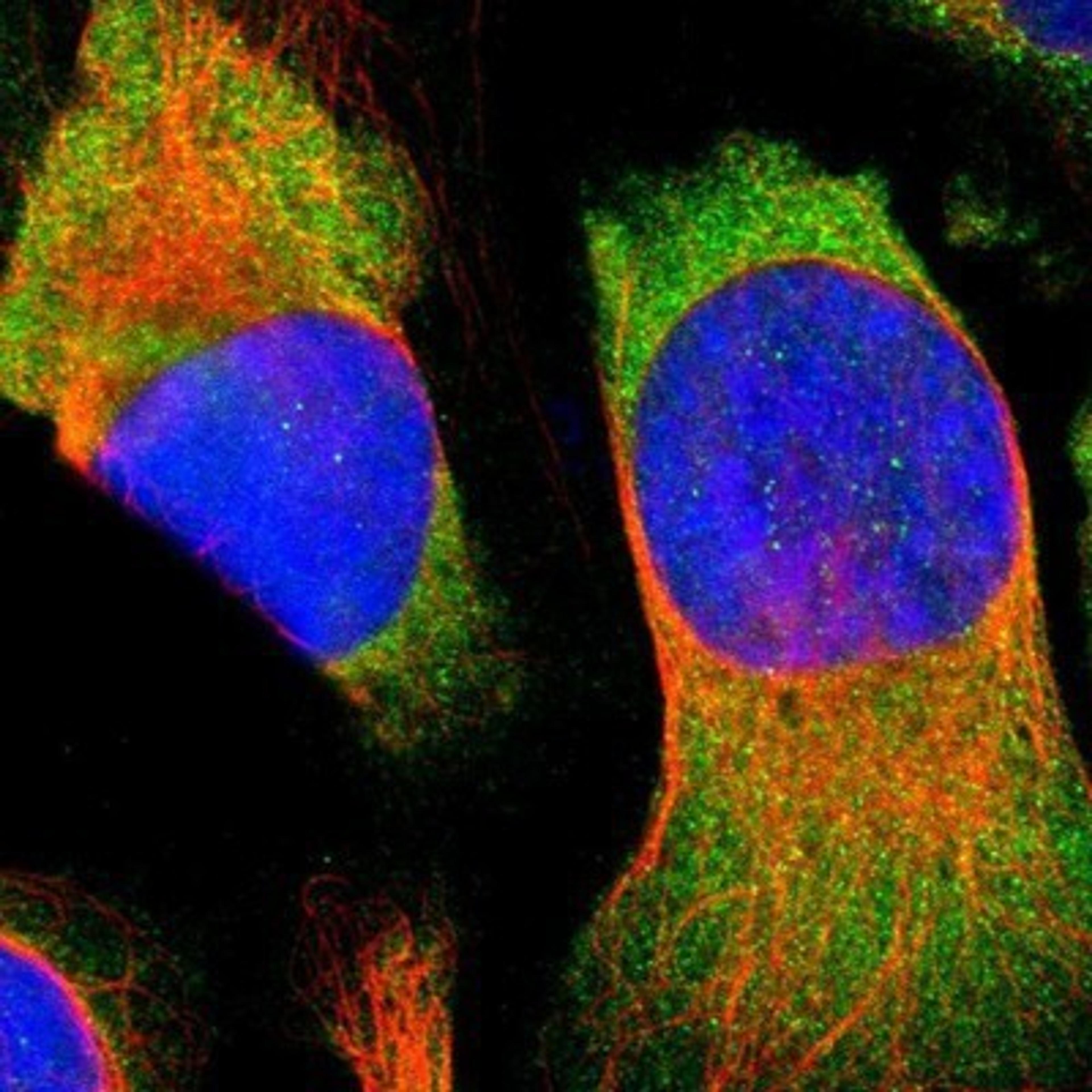 Immunocytochemistry/Immunofluorescence: NCAPH Antibody [NBP1-88345] - Staining of human cell line U-2 OS shows positivity in cytoplasm.