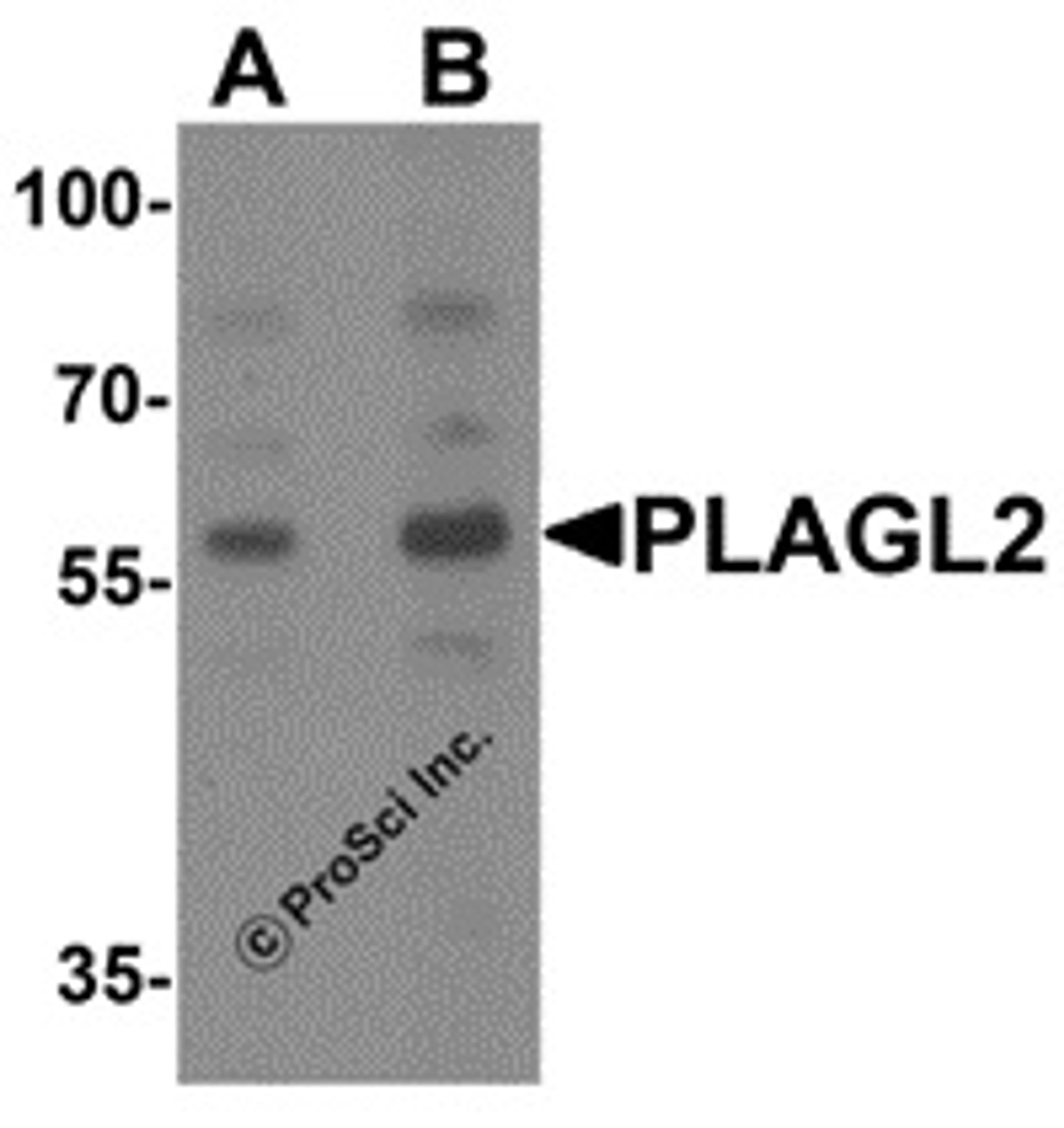 Western blot analysis of PLAGL2 in rat brain tissue lysate with PLAGL2 antibody at (A) 1 and (B) 2 μg/mL.