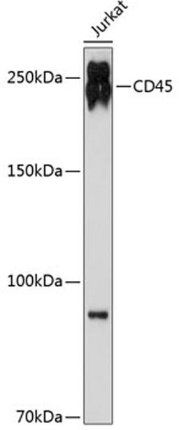 Western blot - CD45 antibody (A19021)