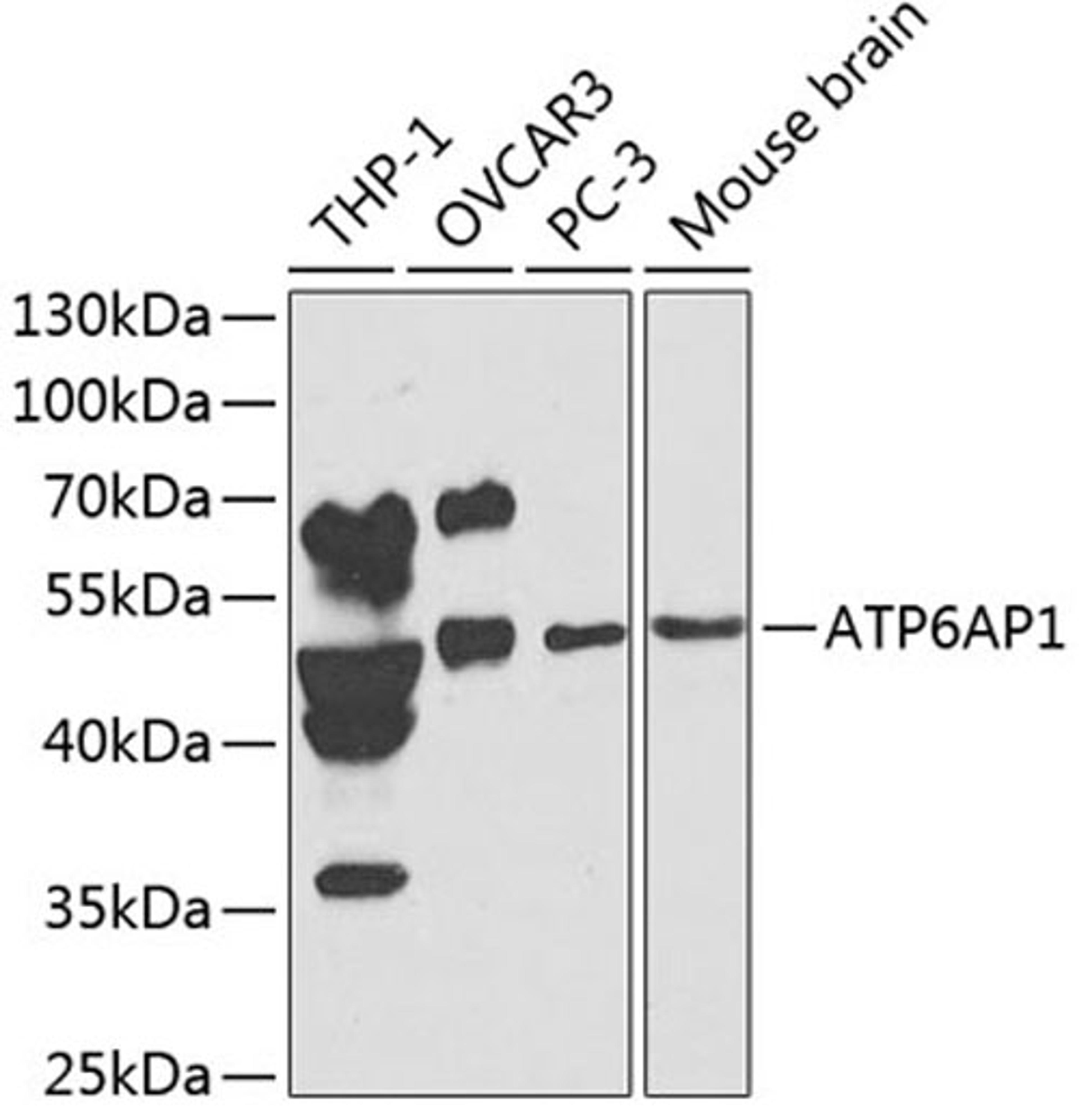 Western blot - ATP6AP1 antibody (A1209)