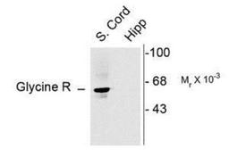 Western Blot: Glycine Receptor Alpha 1 Antibody [NB300-113] - Rat spinal cord showing specific immunolabeling of the ~48k a1- and a2-subunits of the glycine receptor. The labeling was absent from a Rat hippocampal (hipp) lysate as the glycine receptor is not expressed in the hippocampus.