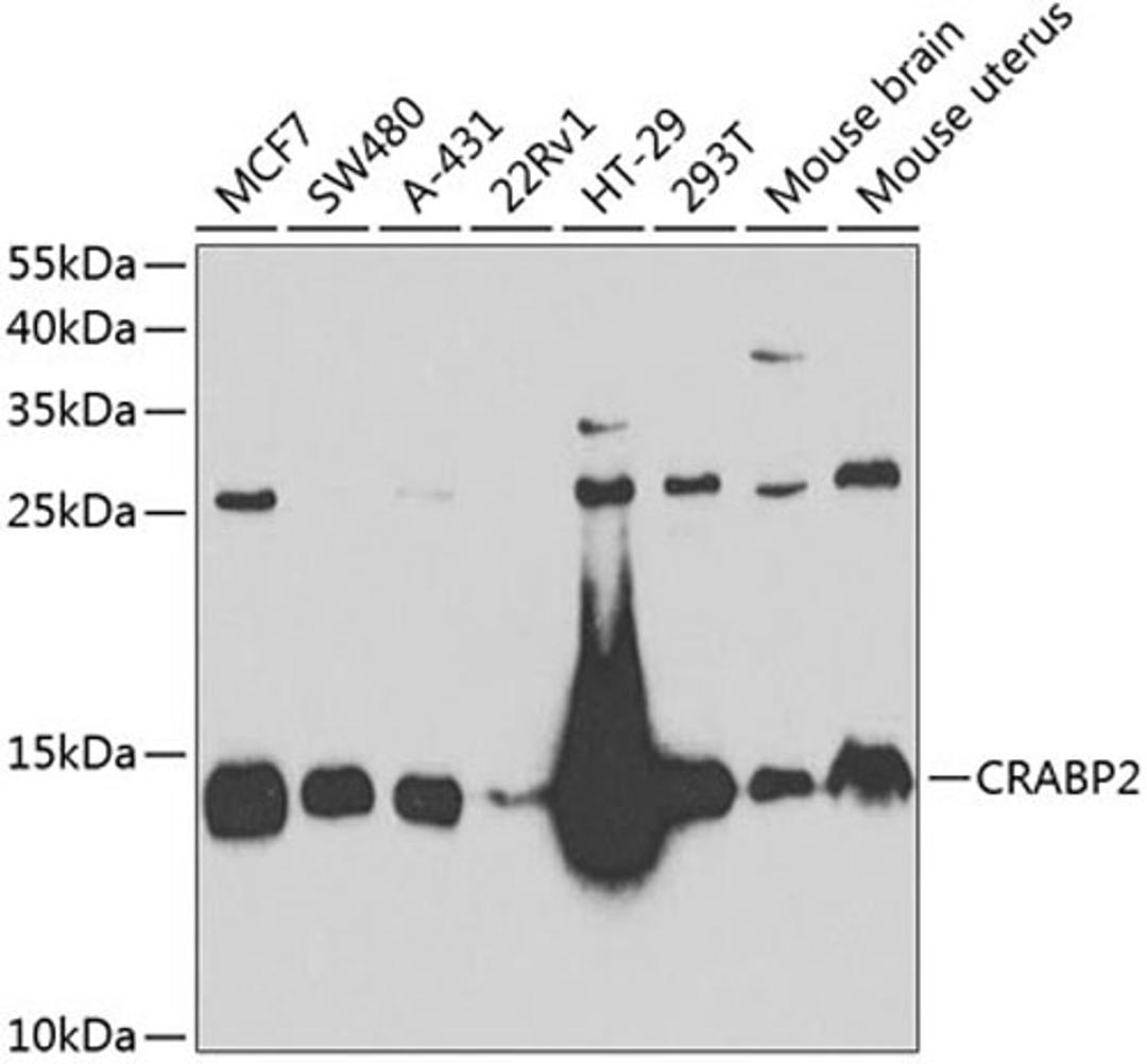 Western blot - CRABP2 antibody (A6119)