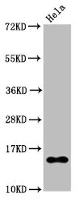 Western Blot. Positive WB detected in Hela whole cell lysate treated by 15mM sodium butyrate for 30min. All lanes Acetyl-Histone H2B type 1-B(K20)antibody at 0.135μg/ml. Secondary. Goat polyclonal to rabbit IgG at 1/50000 dilution. Predicted band size: 15 KDa. Observed band size: 15 KDa. 