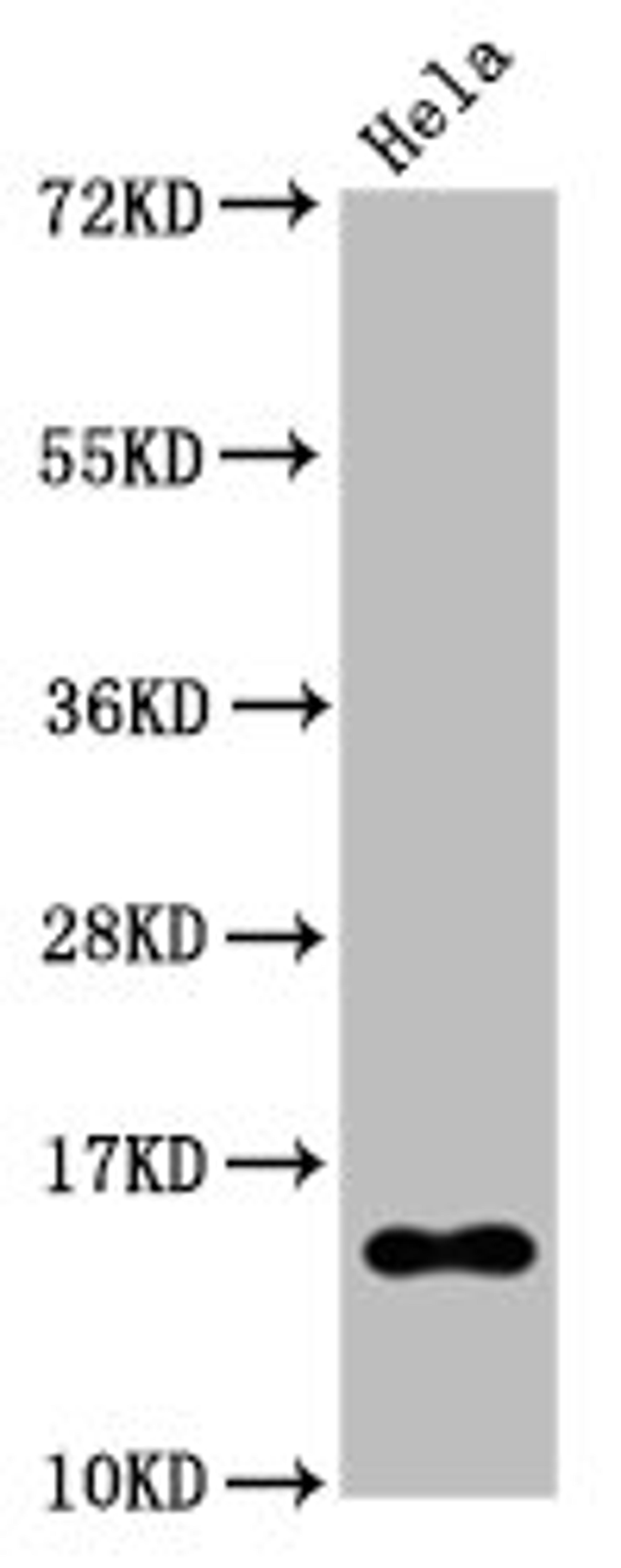 Western Blot. Positive WB detected in Hela whole cell lysate treated by 15mM sodium butyrate for 30min. All lanes Acetyl-Histone H2B type 1-B(K20)antibody at 0.135μg/ml. Secondary. Goat polyclonal to rabbit IgG at 1/50000 dilution. Predicted band size: 15 KDa. Observed band size: 15 KDa. 