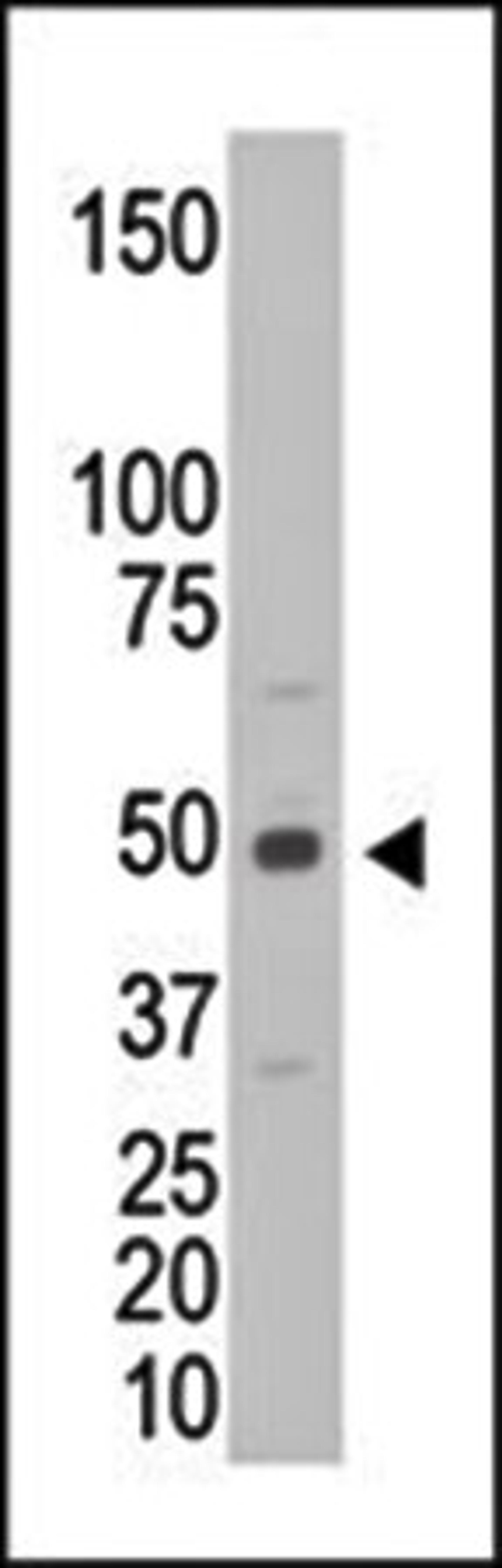 Western blot analysis of CKM antibody in C6 cell lysates