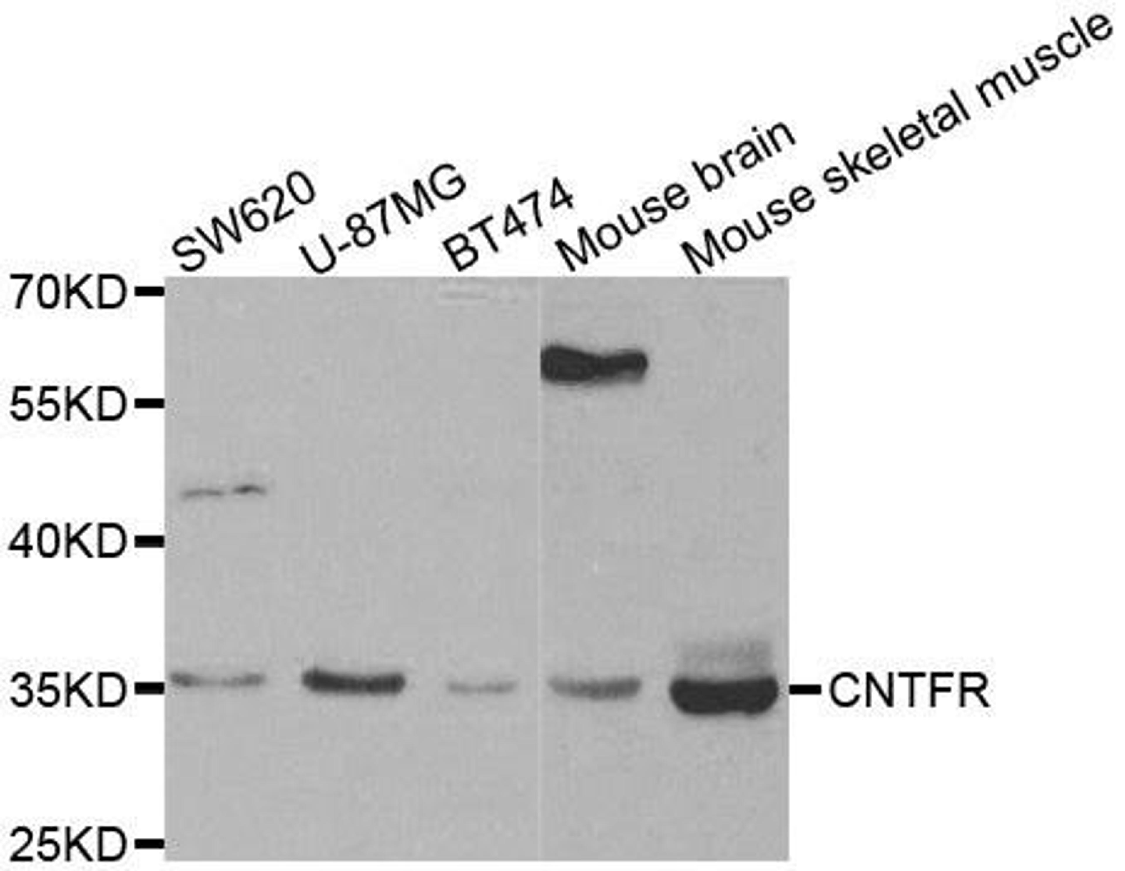 Western blot analysis of extracts of various cell lines using CNTFR antibody