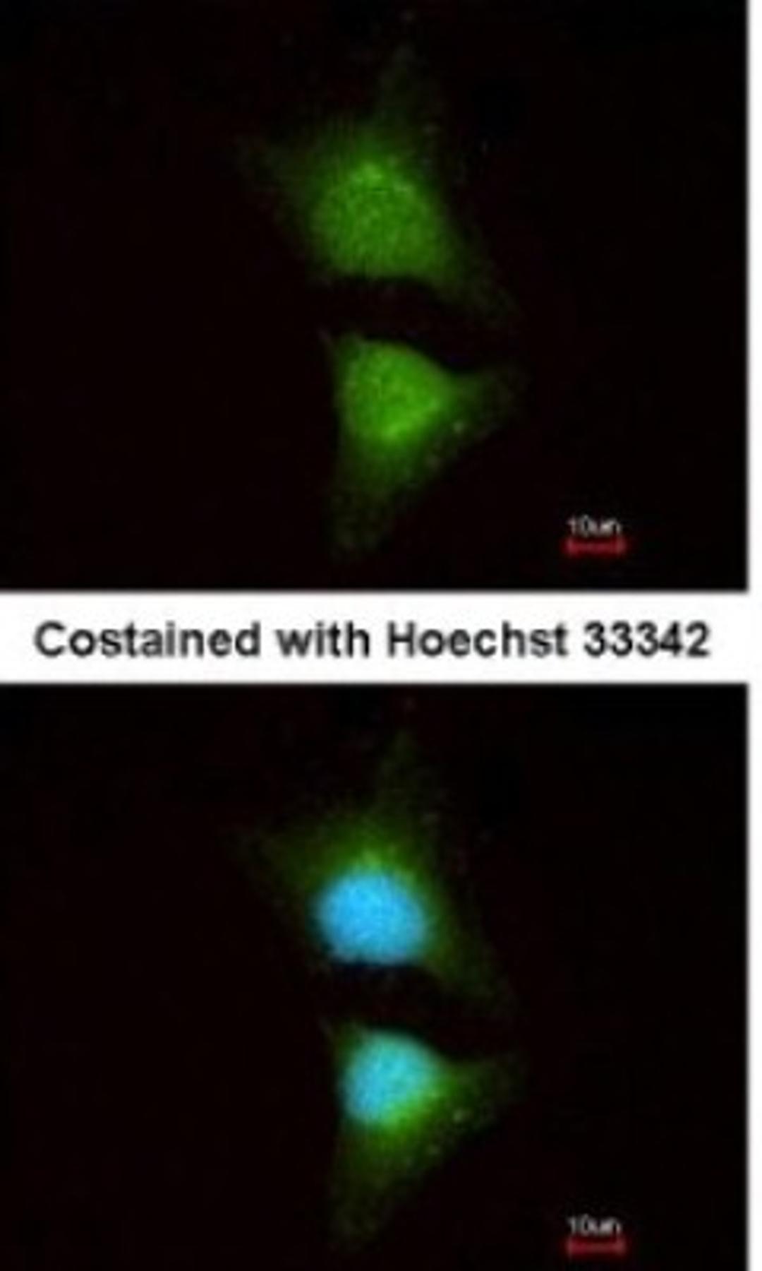 Immunocytochemistry/Immunofluorescence: PIK3CB/p110beta Antibody [NBP1-33116] - Analysis of methanol-fixed HeLa, using antibody at 1:200 dilution.