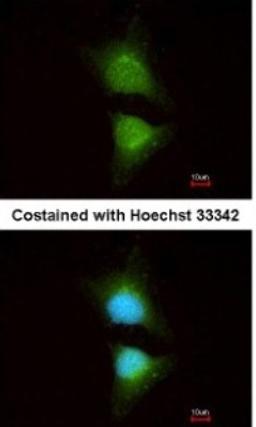 Immunocytochemistry/Immunofluorescence: PIK3CB/p110beta Antibody [NBP1-33116] - Analysis of methanol-fixed HeLa, using antibody at 1:200 dilution.