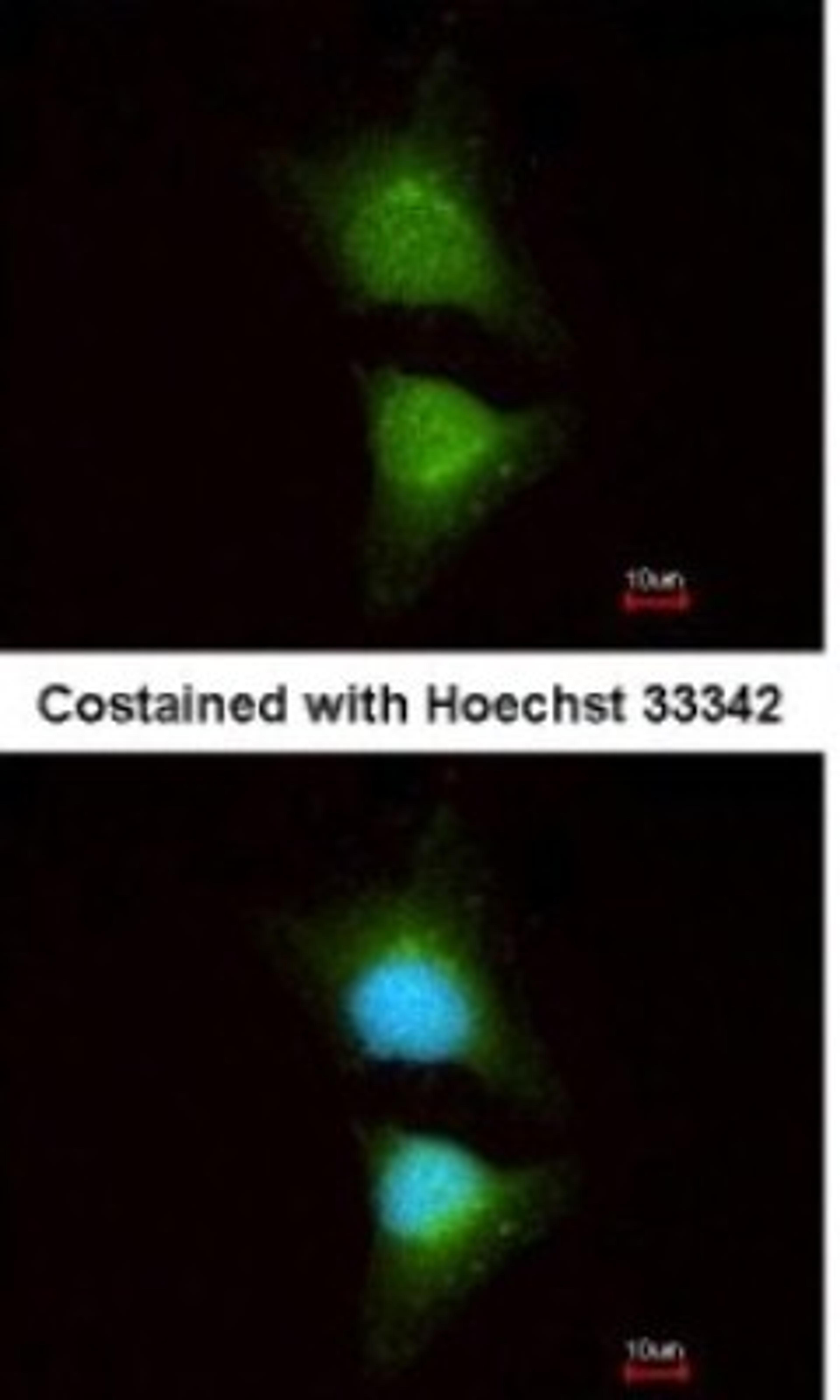 Immunocytochemistry/Immunofluorescence: PIK3CB/p110beta Antibody [NBP1-33116] - Analysis of methanol-fixed HeLa, using antibody at 1:200 dilution.