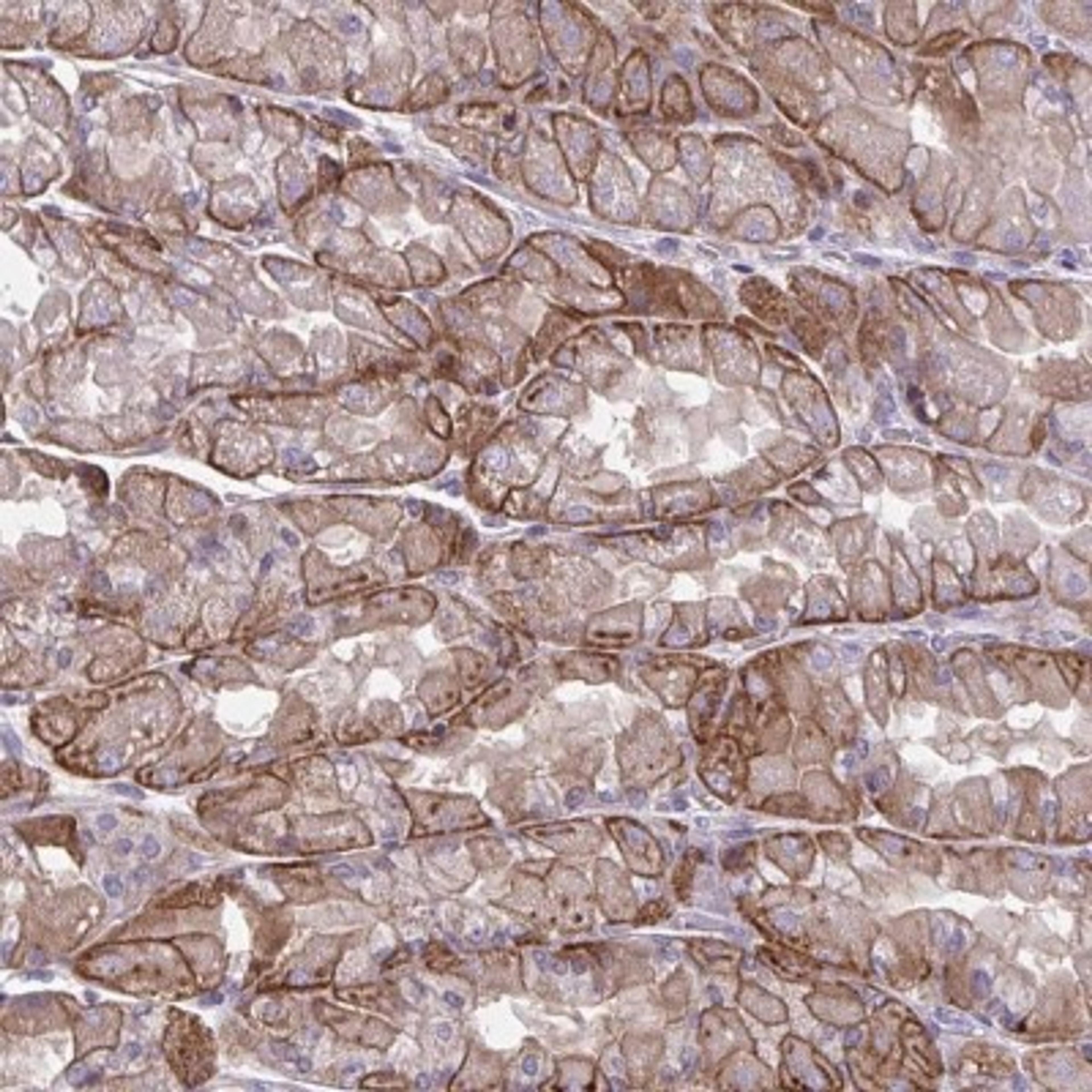 Immunohistochemistry: TTC7B Antibody [NBP2-31782] - Staining of human stomach, upper shows strong membranous and cytoplasmic positivity in glandular cells.