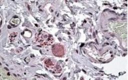 Immunohistochemistry-Paraffin: NPY5R Antibody [NB100-1538] - (3.8ug/ml) staining of paraffin embedded Human Intestine. Steamed antigen retrieval with citrate buffer pH 6, AP-staining.