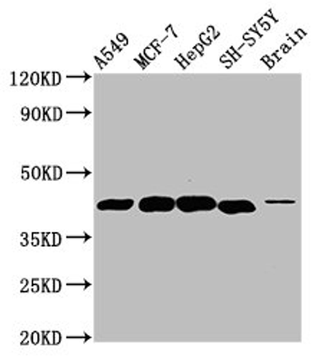 Western Blot. Positive WB detected in: A549 whole cell lysate, MCF-7 whole cell lysate, HepG2 whole cell lysate, SH-SY5Y whole cell lysate, Rat brain tissue. All lanes: DLK1 antibody at 4.6µg/ml. Secondary. Goat polyclonal to rabbit IgG at 1/50000 dilution. Predicted band size: 42, 34 kDa. Observed band size: 42 kDa