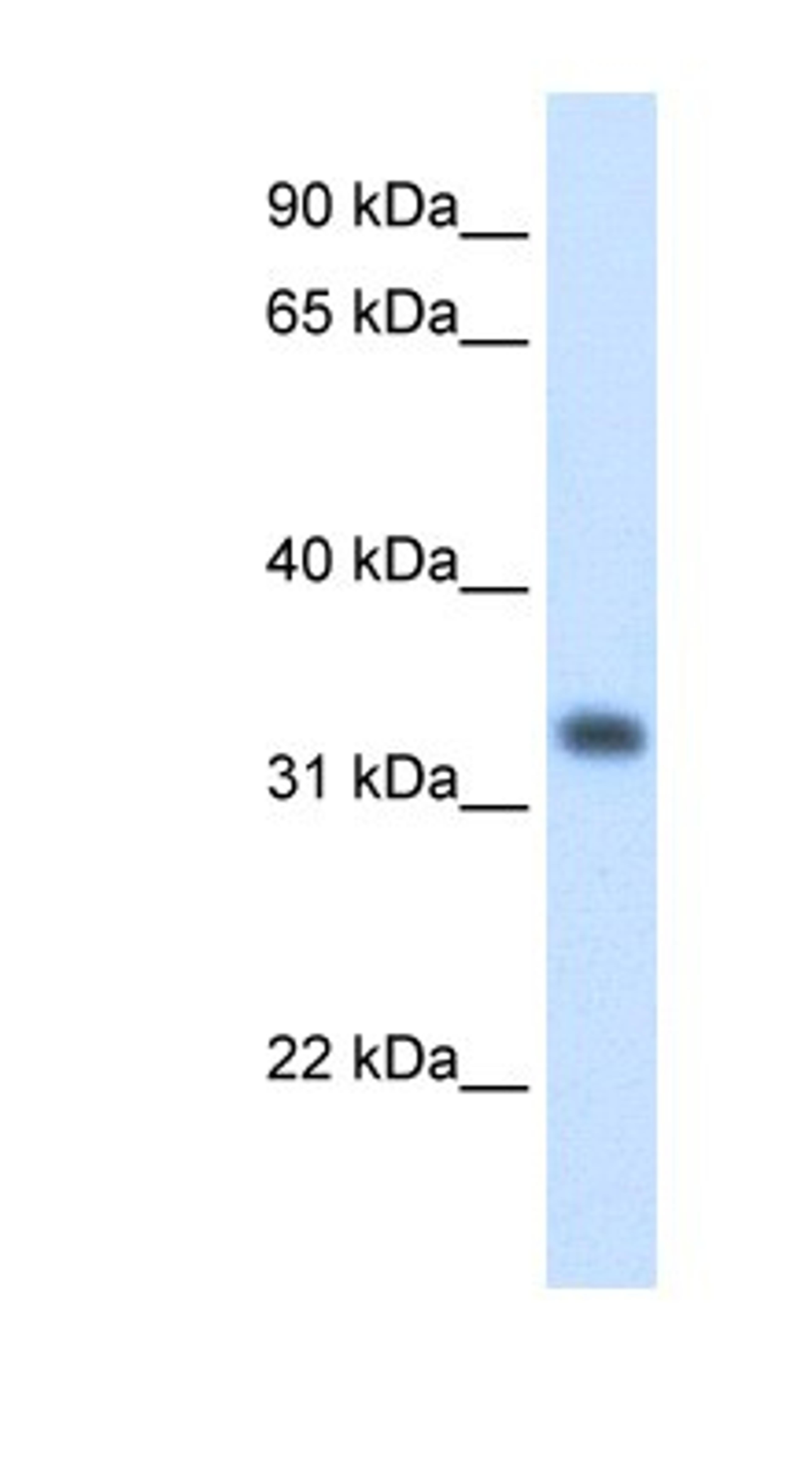 Western Blot: HMGCL Antibody [NBP1-58026] - Titration: 1.25ug/ml Positive Control: Human Liver.