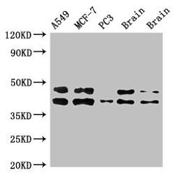 Western Blot. Positive WB detected in: A549 whole cell lysate, MCF-7 whole cell lysate, PC-3 whole cell lysate, Rat brain tissue, Mouse brain tissue. All lanes: PRKACB antibody at 3ug/ml. Secondary. Goat polyclonal to rabbit IgG at 1/50000 dilution. Predicted band size: 41, 47, 40, 42, 30, 37 kDa. Observed band size: 41, 47 kDa.