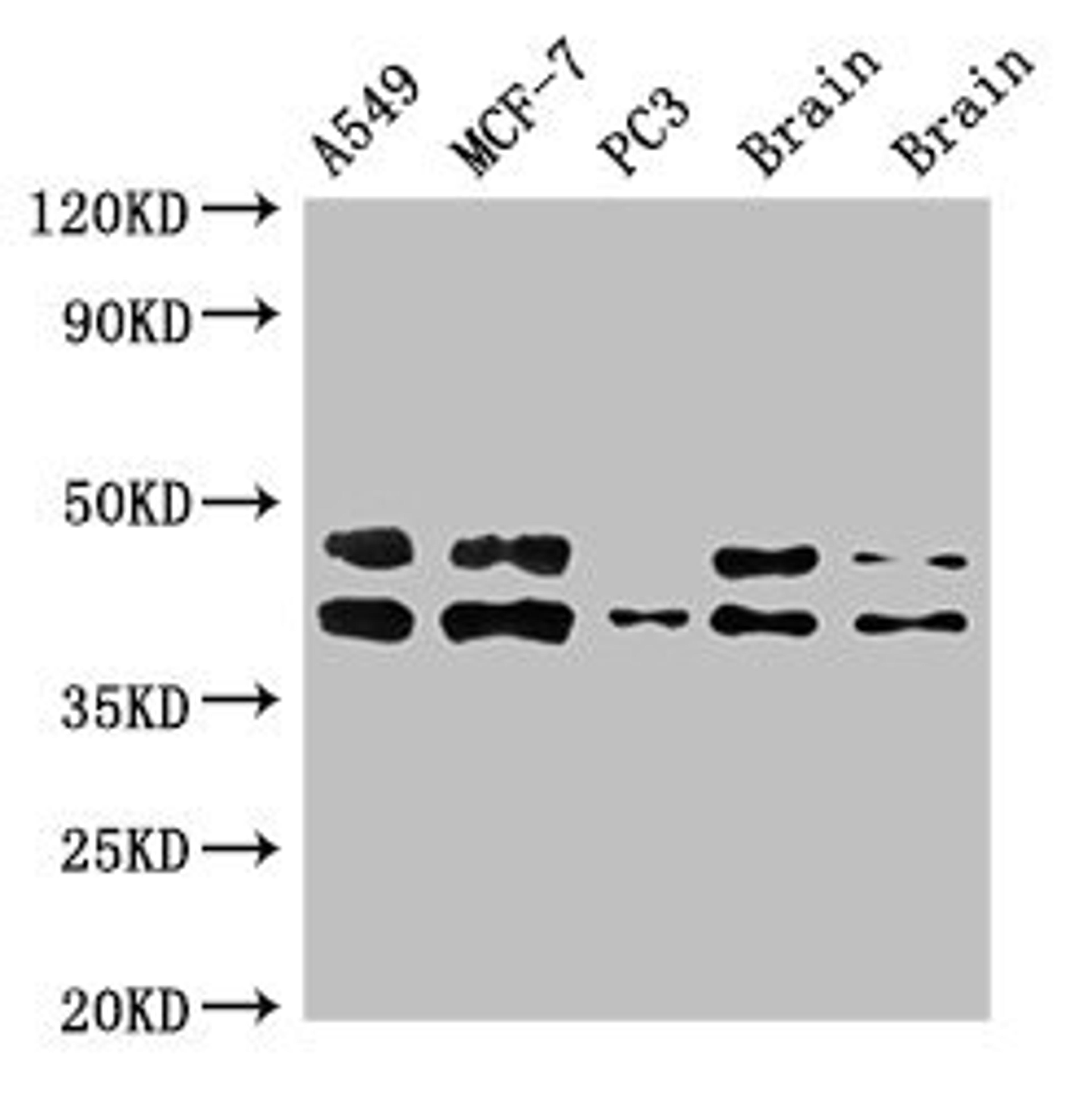 Western Blot. Positive WB detected in: A549 whole cell lysate, MCF-7 whole cell lysate, PC-3 whole cell lysate, Rat brain tissue, Mouse brain tissue. All lanes: PRKACB antibody at 3ug/ml. Secondary. Goat polyclonal to rabbit IgG at 1/50000 dilution. Predicted band size: 41, 47, 40, 42, 30, 37 kDa. Observed band size: 41, 47 kDa.