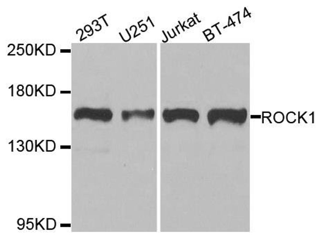 Western blot analysis of extracts of various cell lines using ROCK1 antibody