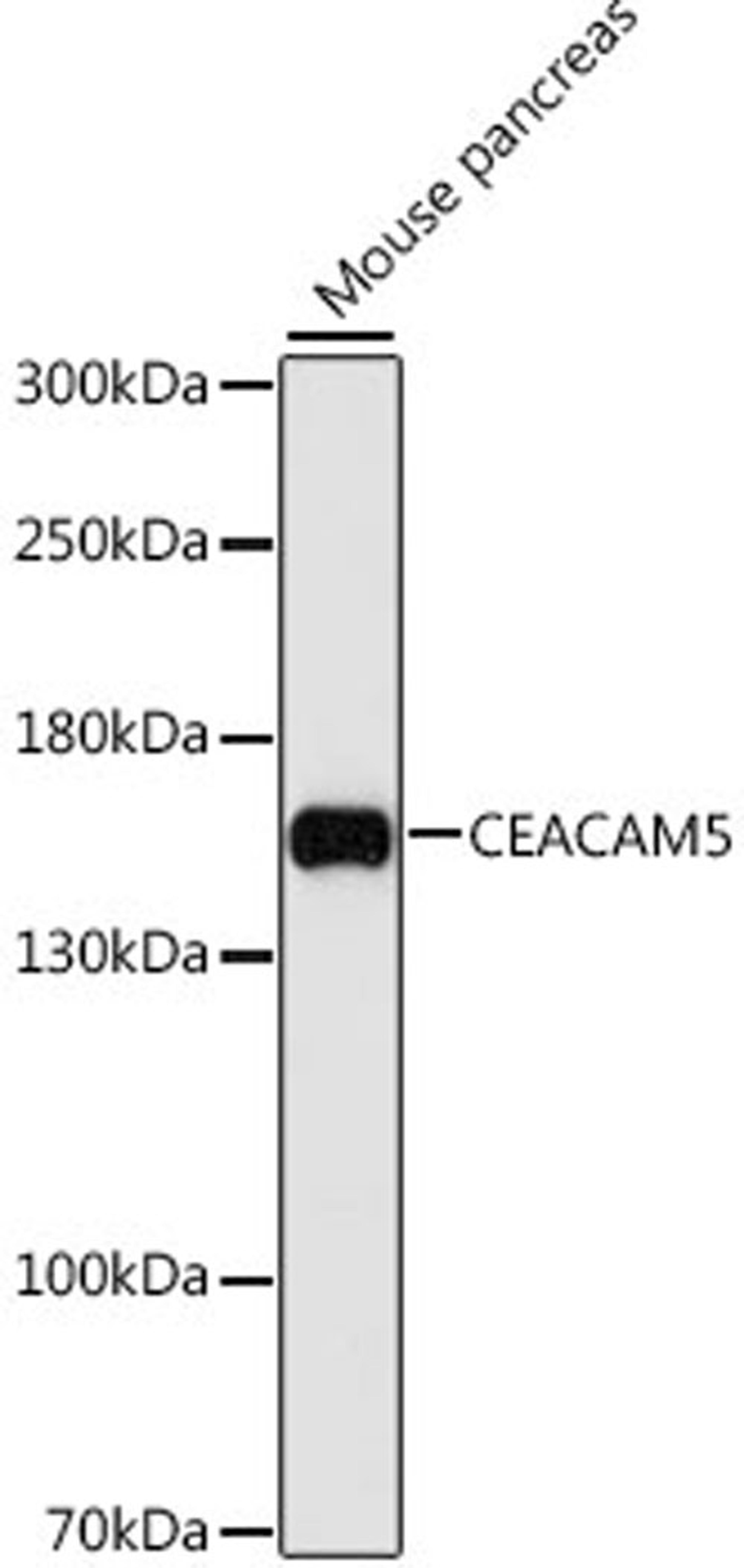 Western blot - CEACAM5 antibody (A12421)