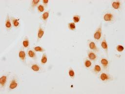 Immunocytochemistry analysis of CSB-PA010429PA77acHU diluted at 1:10 and staining in Hela cells(treated with 30mM sodium butyrate for 4h) performed on a Leica BondTM system. The cells were fixed in 4% formaldehyde, permeabilized using 0.2% Triton X-100 and blocked with 10% normal goat serum 30min at RT. Then primary antibody (1% BSA) was incubated at 4°C overnight. The primary is detected by a biotinylated secondary antibody and visualized using an HRP conjugated SP system.