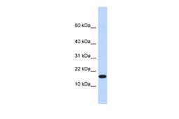 Antibody used in WB on Human Heart at 0.2-1 ug/ml.