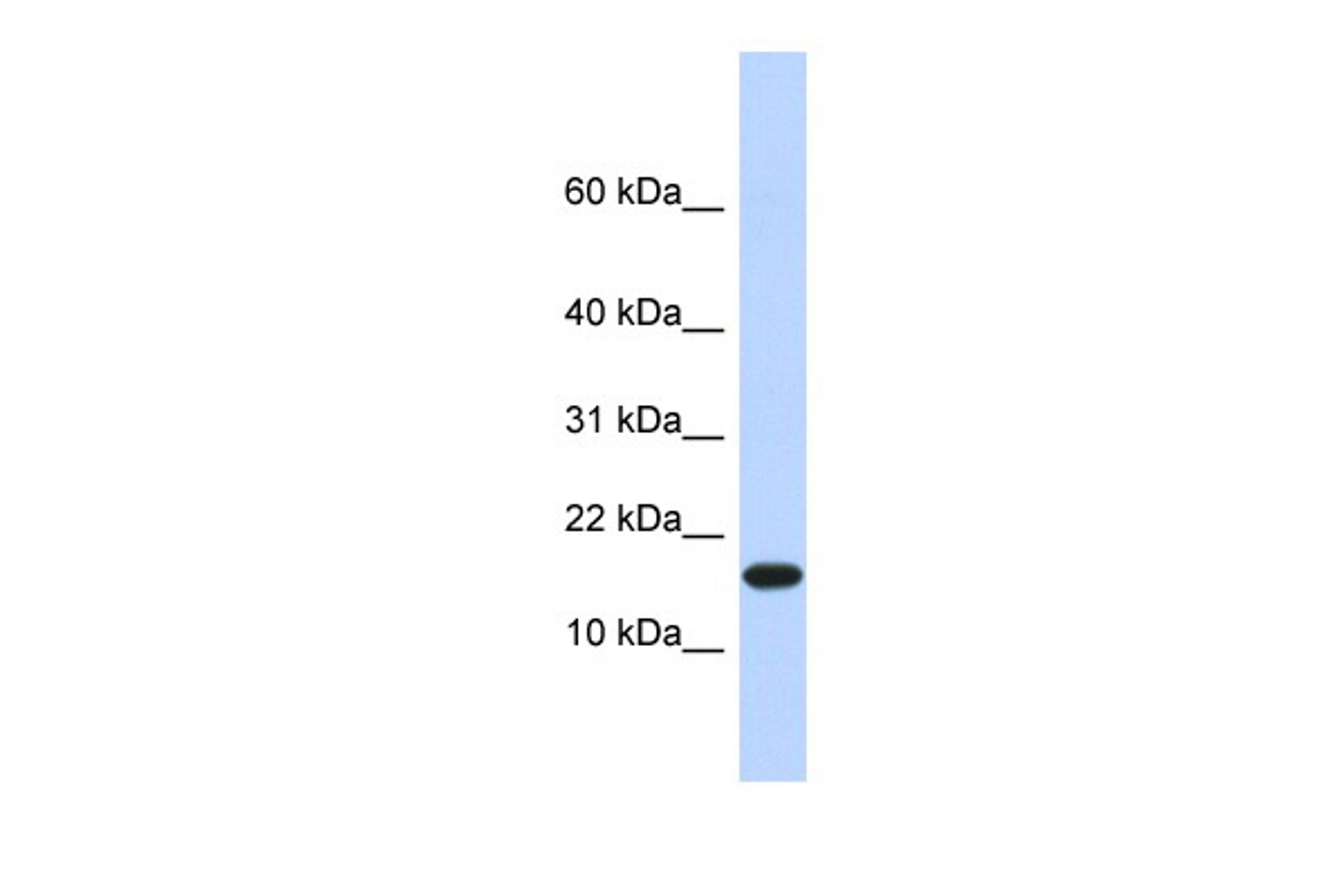 Antibody used in WB on Human Heart at 0.2-1 ug/ml.