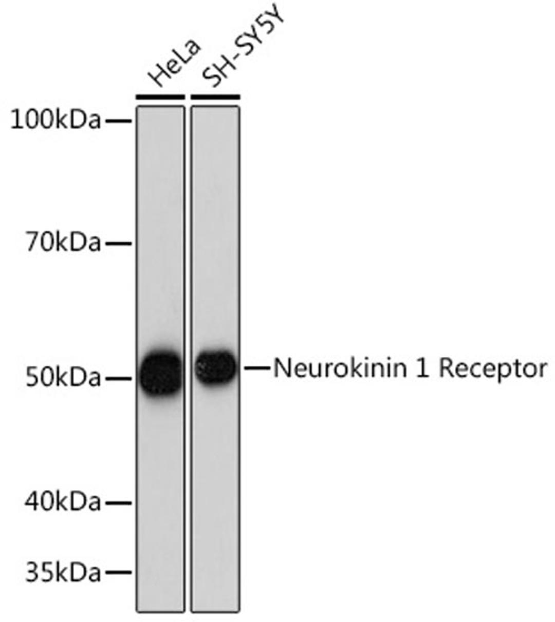 Western blot - Neurokinin 1 Receptor Rabbit mAb (A4676)