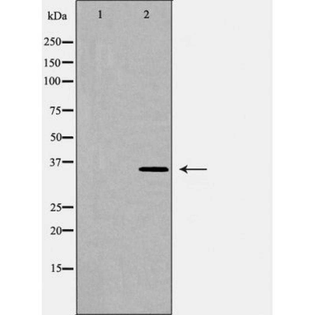 Western blot analysis of K562 cell lysate using HO 2 antibody