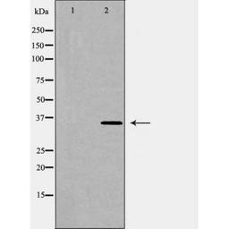 Western blot analysis of K562 cell lysate using HO 2 antibody