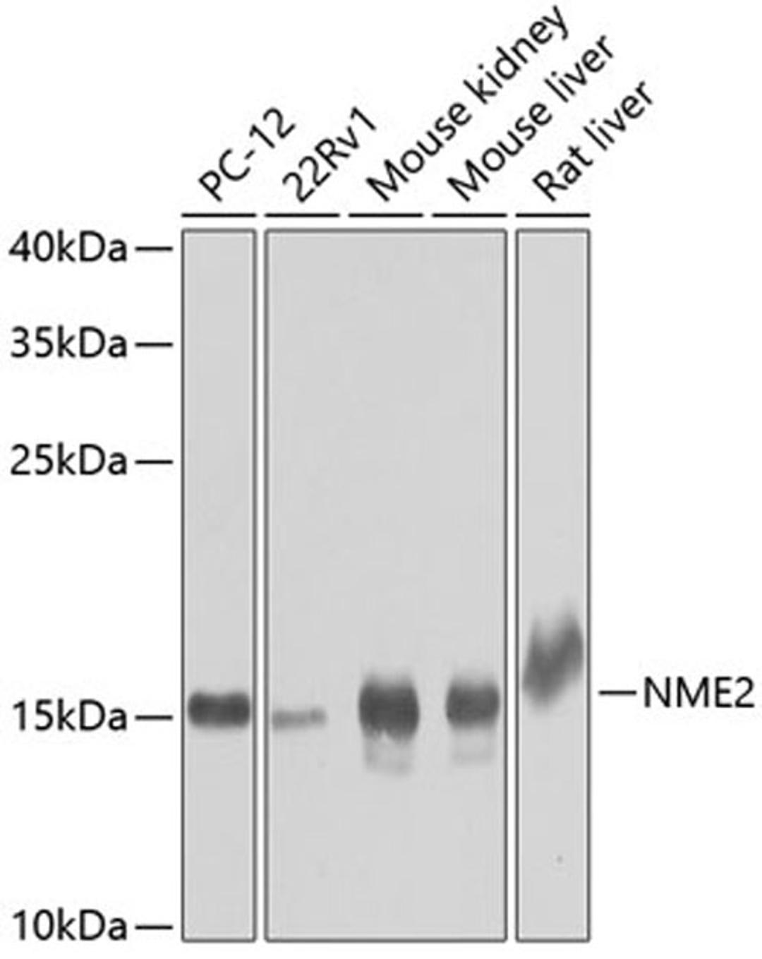 Western blot - NME2 antibody (A7443)