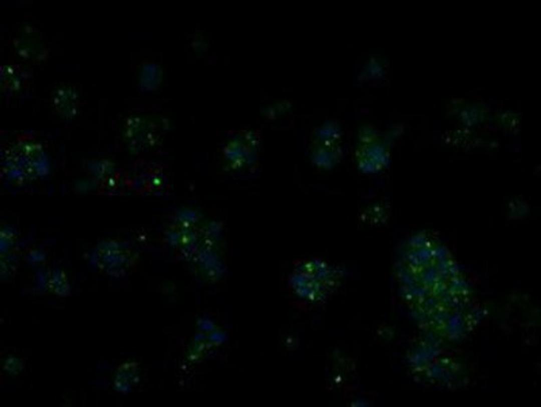 Immunocytochemistry/Immunofluorescence: RIC8 Antibody (3G3) [NBP2-02433] - Immunofluorescent staining of HepG2 cells using anti-RIC8 mouse monoclonal antibody.