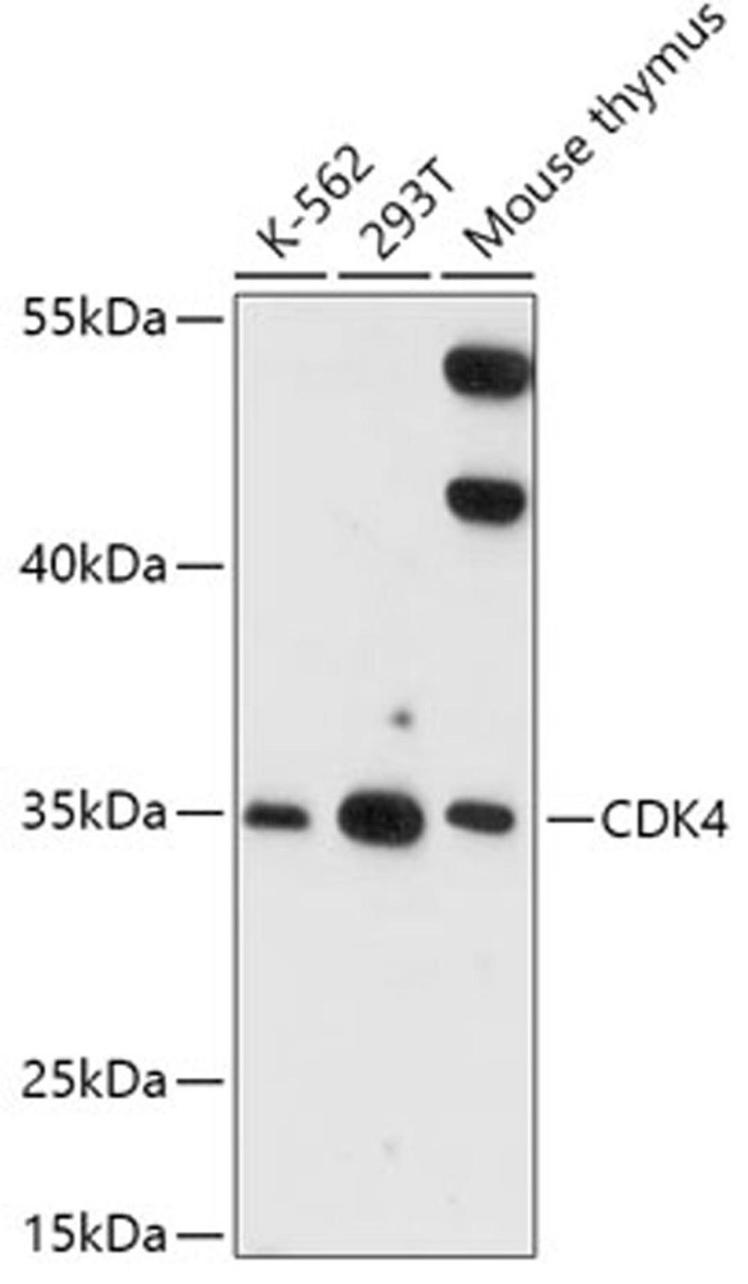 Western blot - CDK4 antibody (A16813)