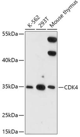 Western blot - CDK4 antibody (A16813)