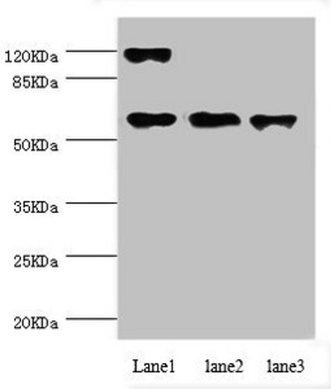 Western blot. All lanes: CCT5 antibody at 1.84ug/ml. Lane 1: Hela whole cell lysate. Lane 2: Colo320 whole cell lysate. Lane 3: Mouse ovarian tissue. Secondary. Goat polyclonal to rabbit IgG at 1/10000 dilution. Predicted band size: 60, 50 kDa. Observed band size: 60 kDa. 