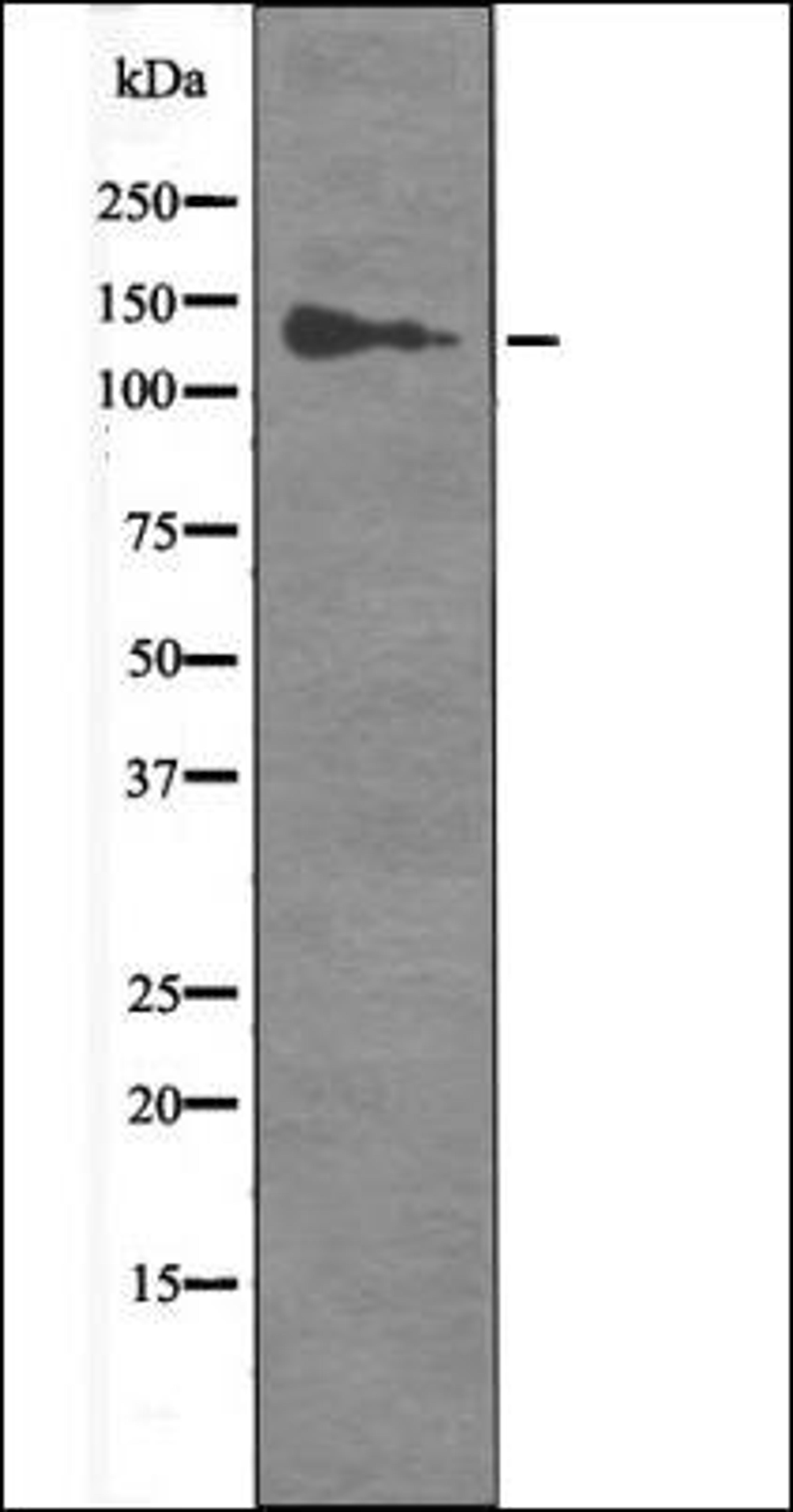 Western blot analysis of HepG2 whole cell lysates using RBL2 -Phospho-Ser952- antibody