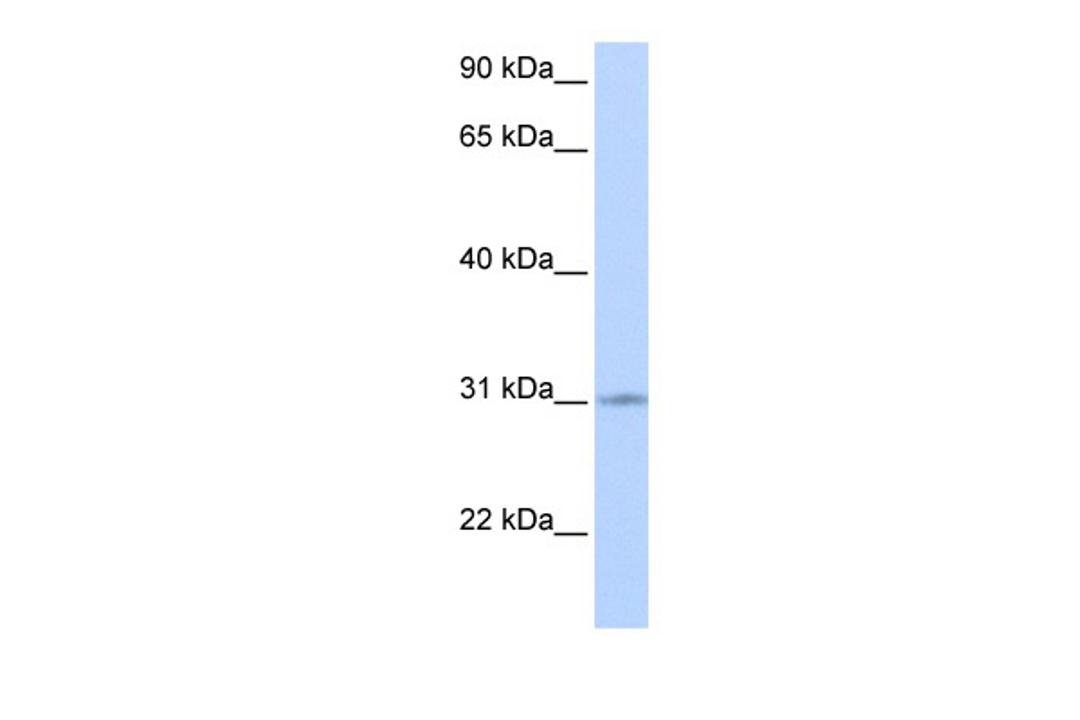 Antibody used in WB on Human Heart at 0.2-1 ug/ml.