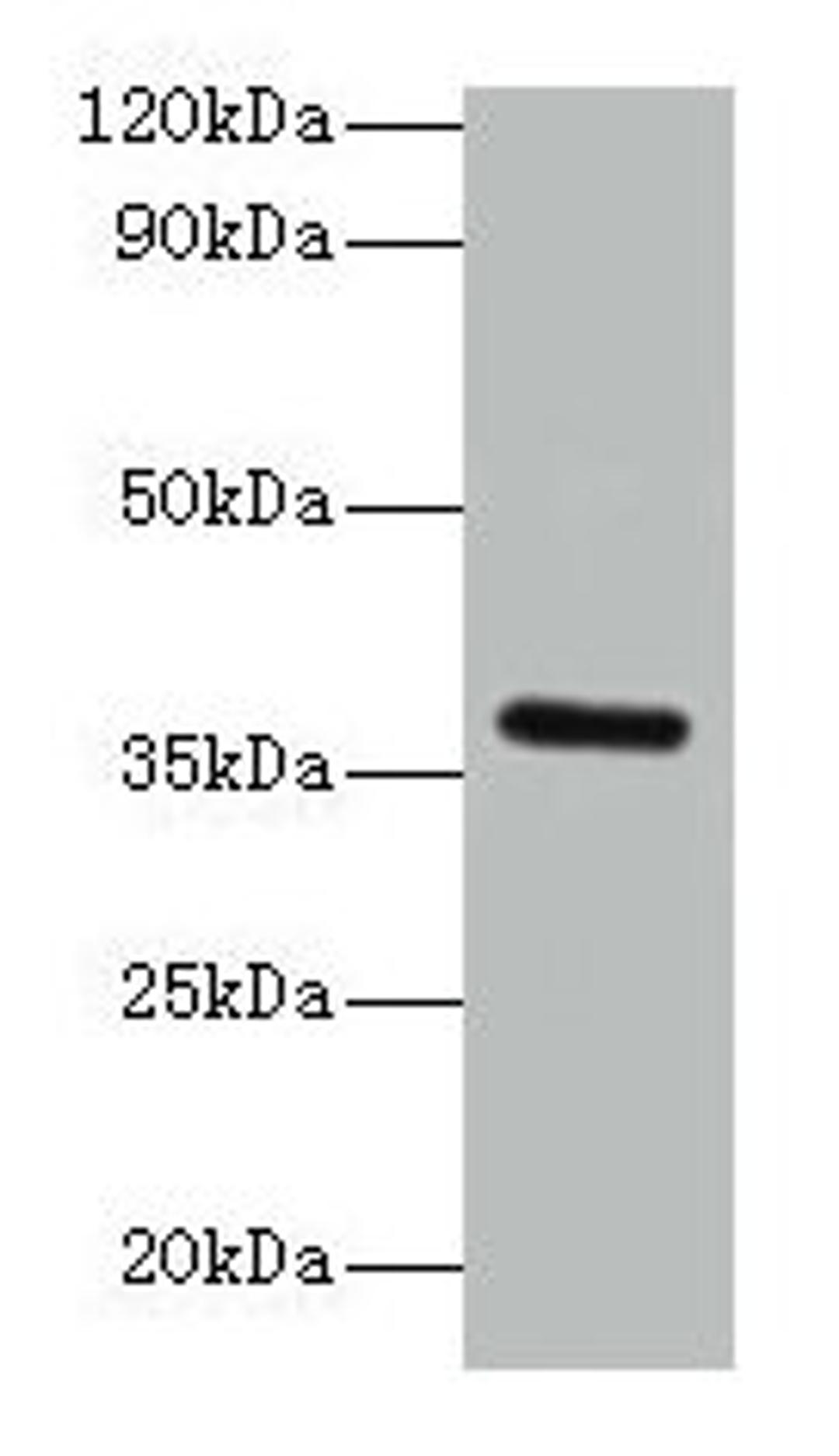 Western blot. All lanes: BRCC3 antibody at 2µg/ml + K562 whole cell lysate. Secondary. Goat polyclonal to rabbit IgG at 1/15000 dilution. Predicted band size: 37, 34, 24, 29 kDa. Observed band size: 37 kDa