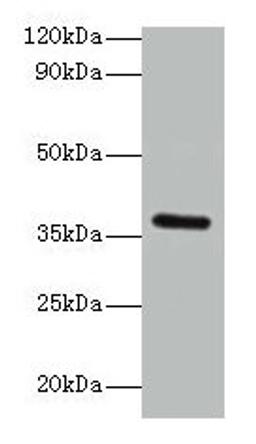 Western blot. All lanes: BRCC3 antibody at 2µg/ml + K562 whole cell lysate. Secondary. Goat polyclonal to rabbit IgG at 1/15000 dilution. Predicted band size: 37, 34, 24, 29 kDa. Observed band size: 37 kDa