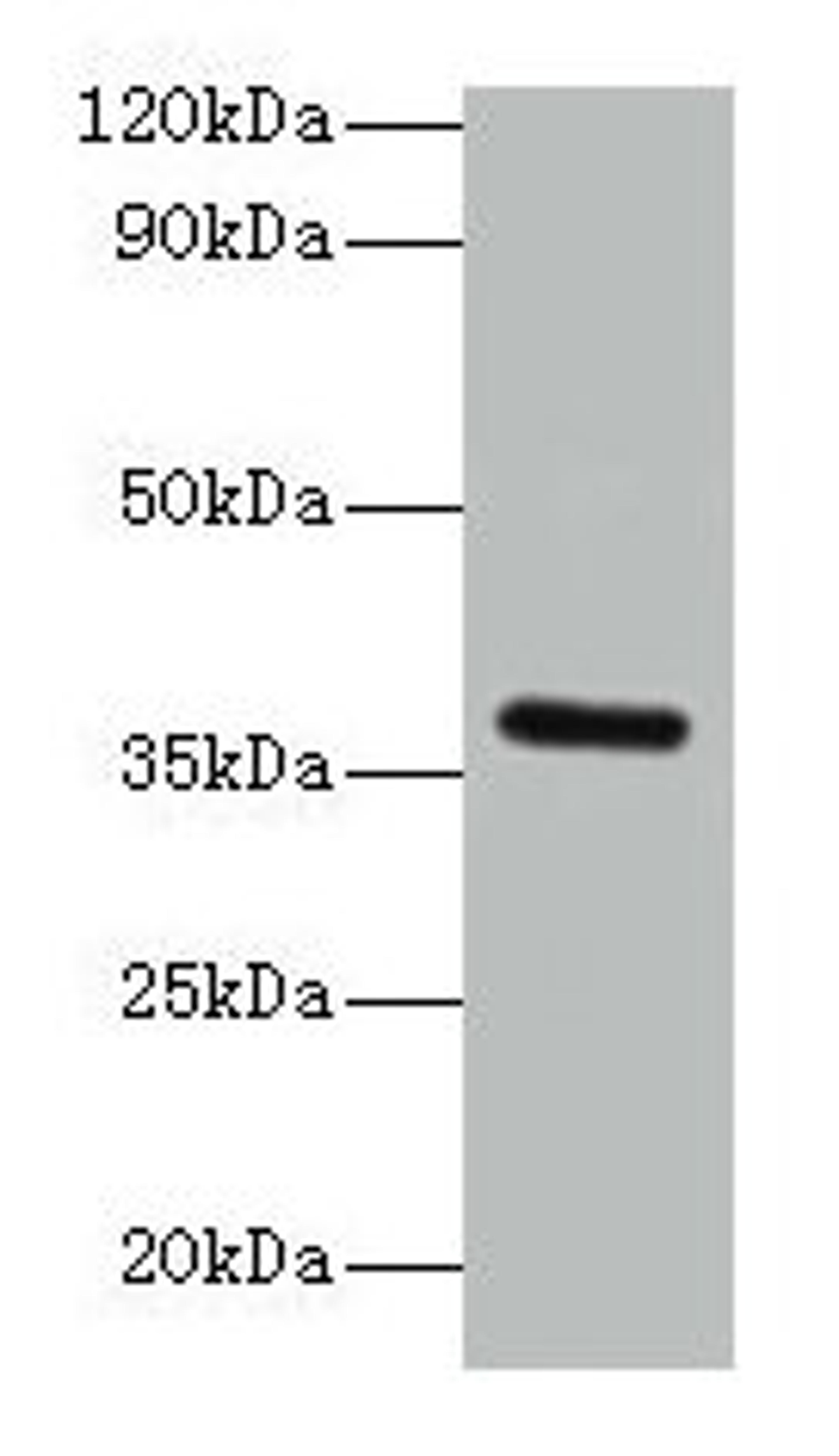 Western blot. All lanes: BRCC3 antibody at 2µg/ml + K562 whole cell lysate. Secondary. Goat polyclonal to rabbit IgG at 1/15000 dilution. Predicted band size: 37, 34, 24, 29 kDa. Observed band size: 37 kDa
