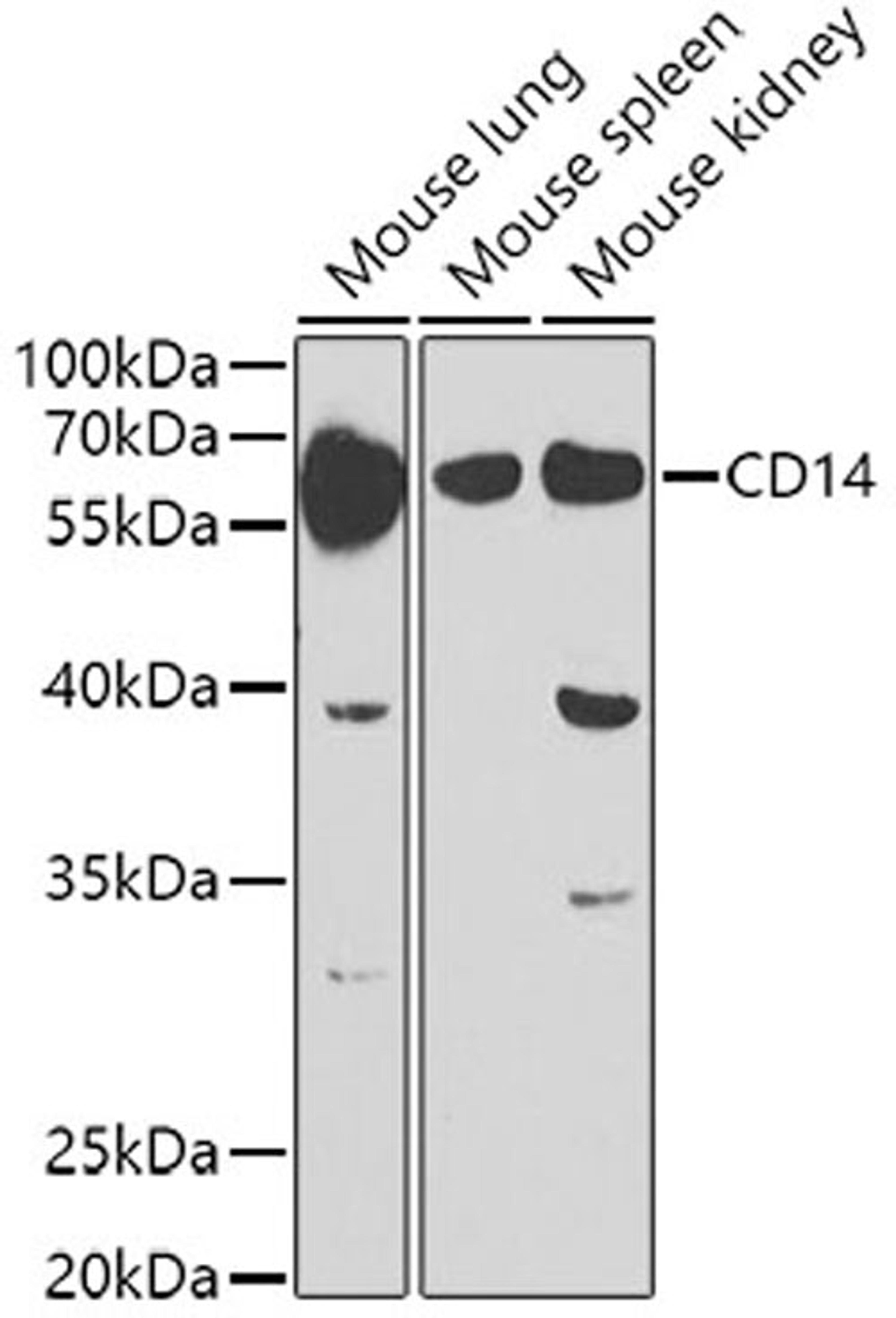 Western blot - CD14 antibody (A5737)