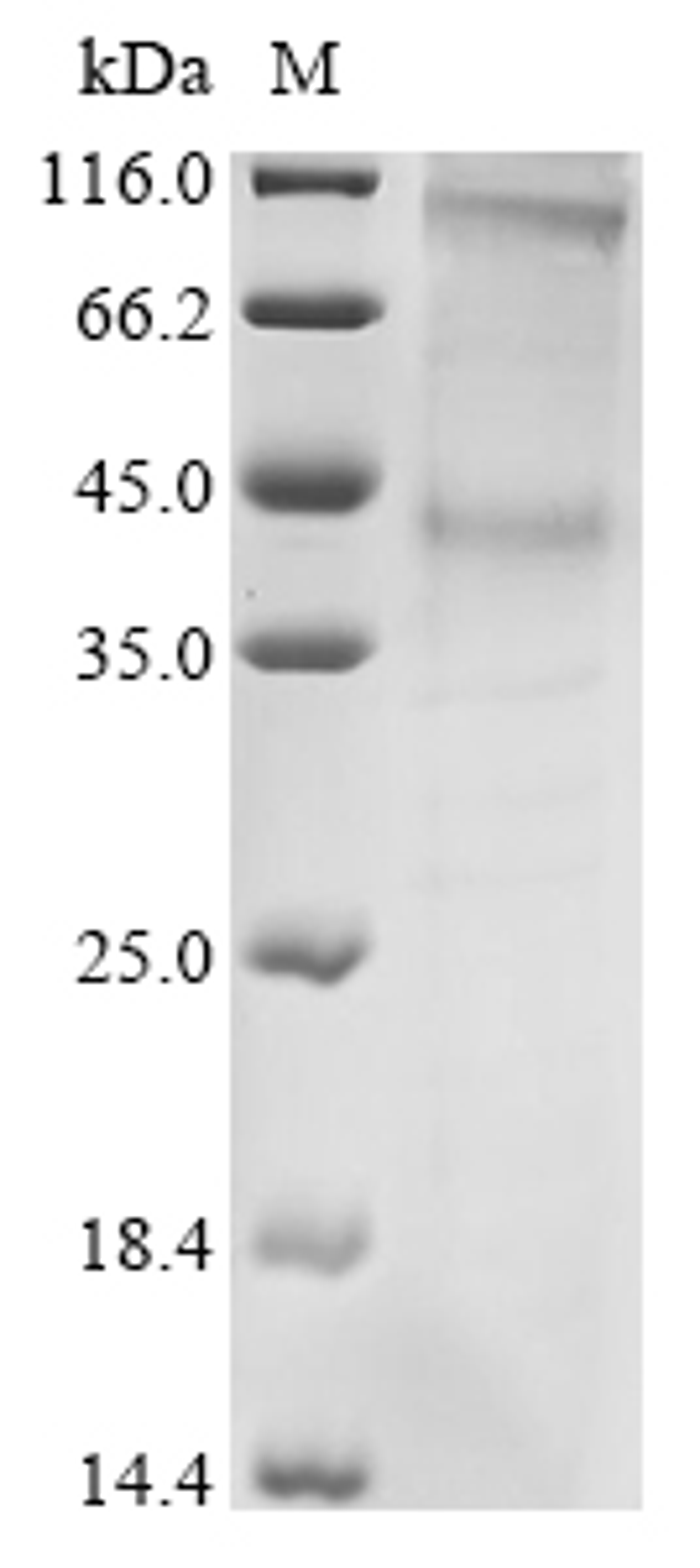 (Tris-Glycine gel) Discontinuous SDS-PAGE (reduced) with 5% enrichment gel and 15% separation gel.