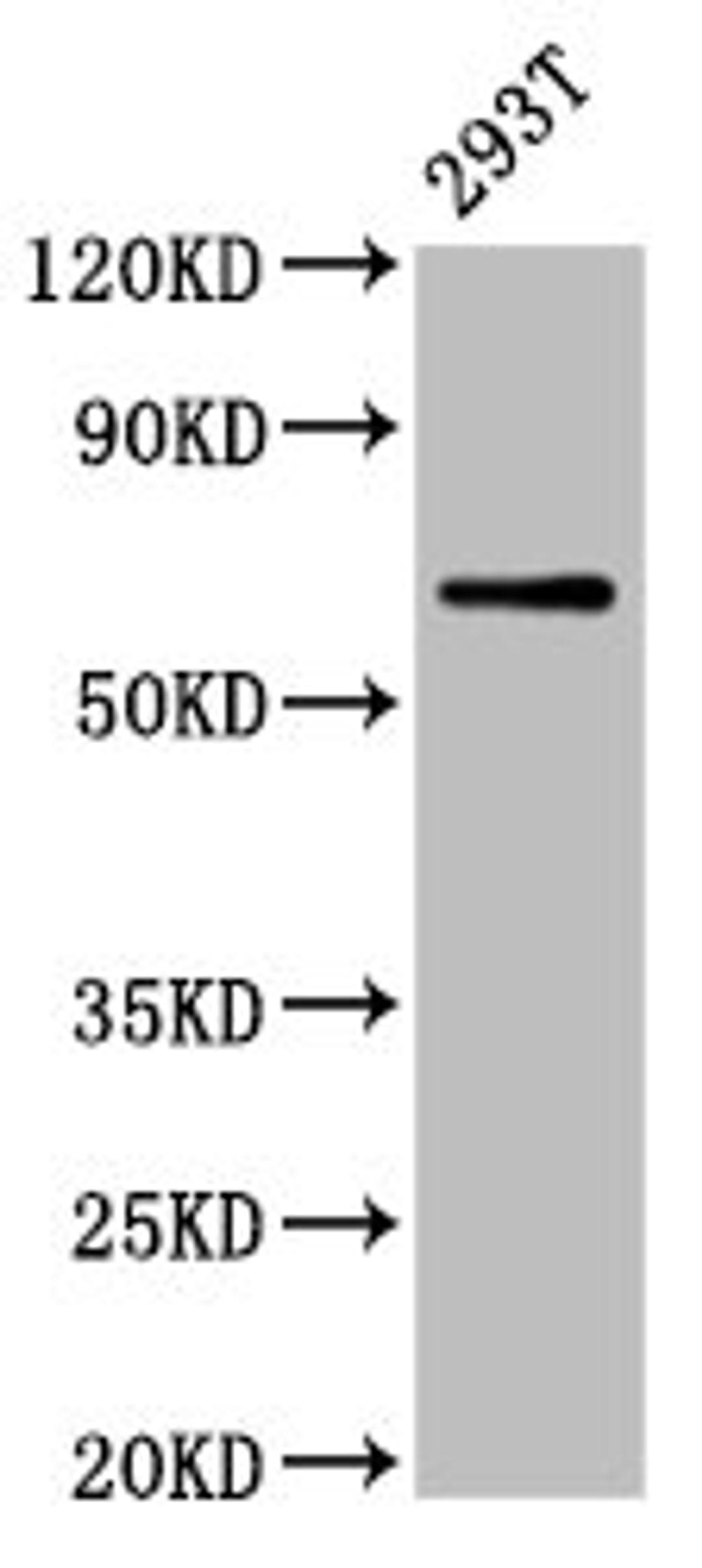 Western Blot. Positive WB detected in: 293T whole cell lysate. All lanes: ARSH antibody at 5.2µg/ml. Secondary. Goat polyclonal to rabbit IgG at 1/50000 dilution. Predicted band size: 64 kDa. Observed band size: 64 kDa
