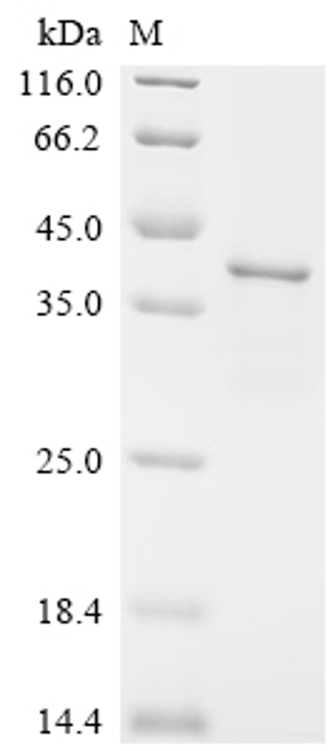 (Tris-Glycine gel) Discontinuous SDS-PAGE (reduced) with 5% enrichment gel and 15% separation gel.